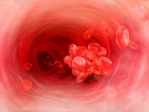 Blood Clot, Vein, Artery, Tunnel, Red Blood Cells, Internal Body, Blood Cell, Heart
